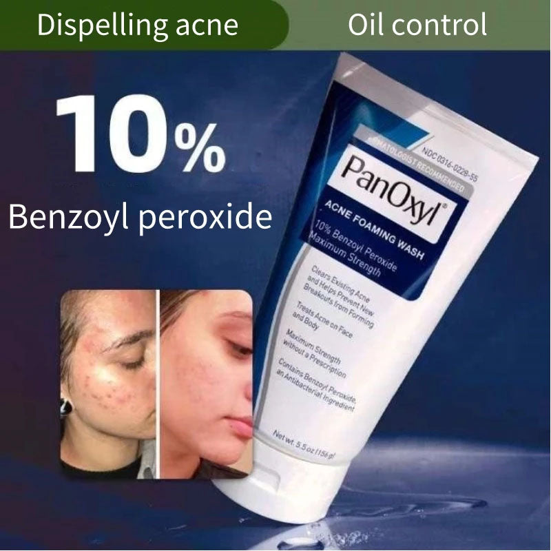 PanOxyl Acne Foaming Wash Benzoyl Peroxide 10% Net Wt 5.5 Oz (156)