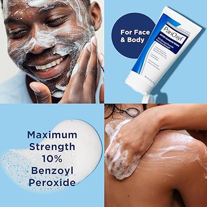 PanOxyl Acne Foaming Wash Benzoyl Peroxide 10% Net Wt 5.5 Oz (156)